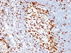 ZAP70 Antibody (ZAP70/528), Novus Biologicals 0.2mg; Unlabeled:Antibodies,